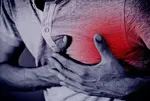 Heart Attack