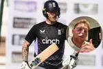 England Captain Ben Stokes Facial Injury
